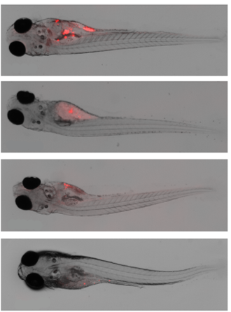 Tumor tracking in zebrafish